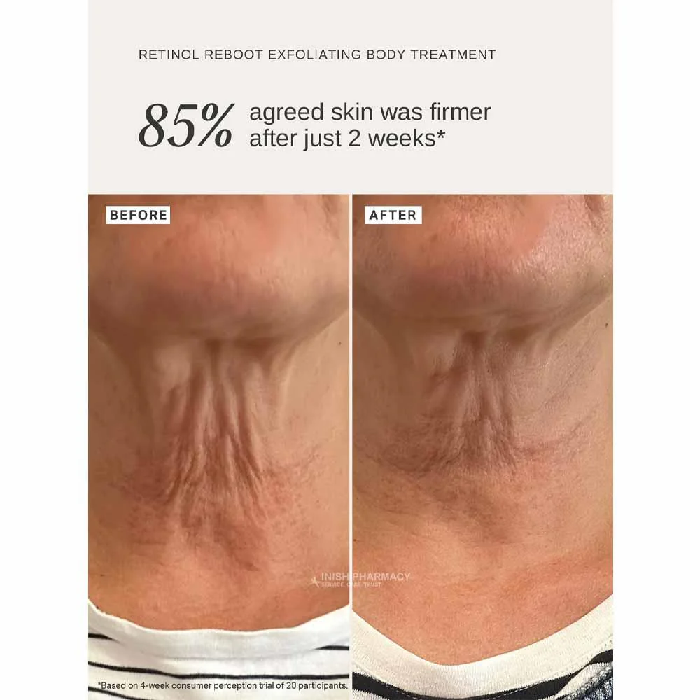 Alpha-H Retinol Reboot Body Treatment 120ml - Image 2
