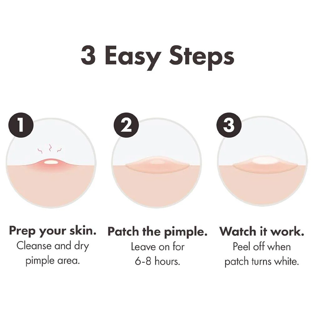 Hero Mighty Patch The Original 36 Pack - Image 4