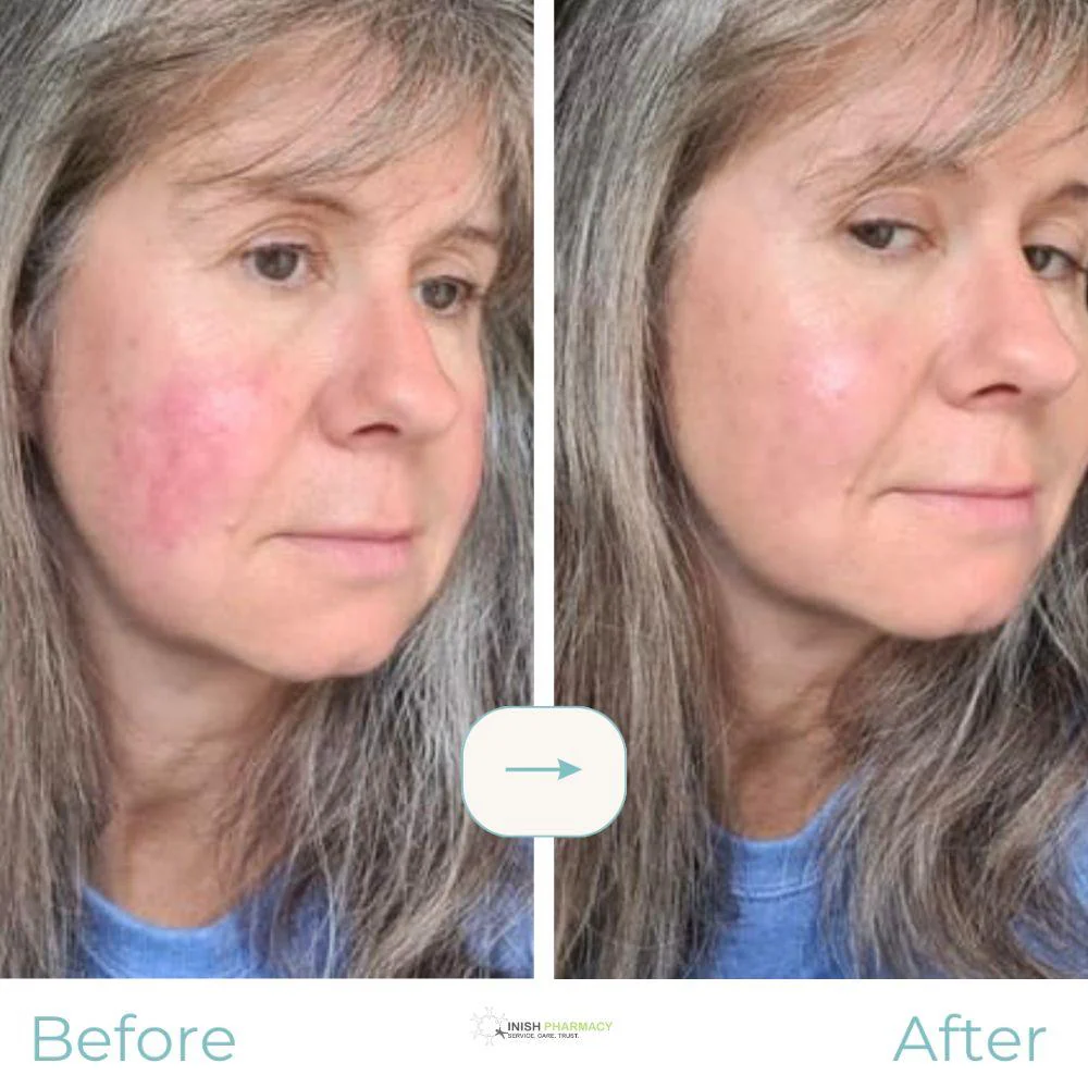 Rosalique 3-in-1 Anti-Redness Miracle Formula SPF50 - Image 8