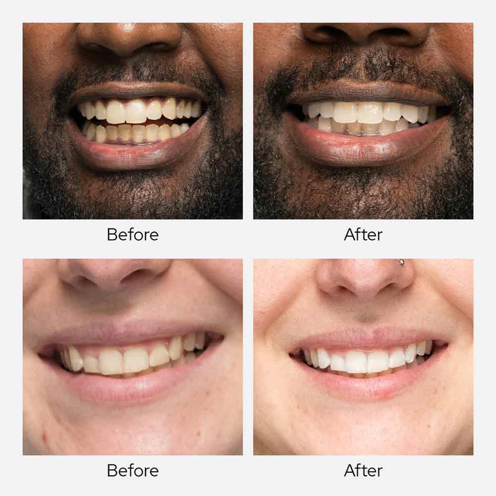 Spotlight Oral Care Teeth Whitening Powder With Diamond PAP+ - Image 5